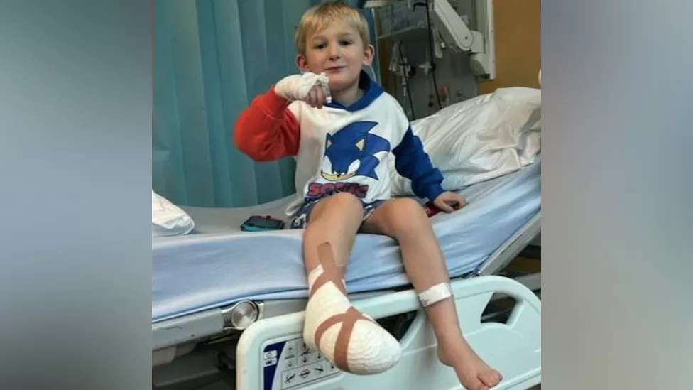 London Bridge: Family sues after boy loses toe on escalator