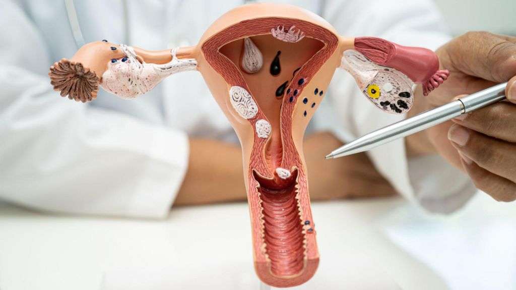 DIY kits may see million more cervical-cancer tests