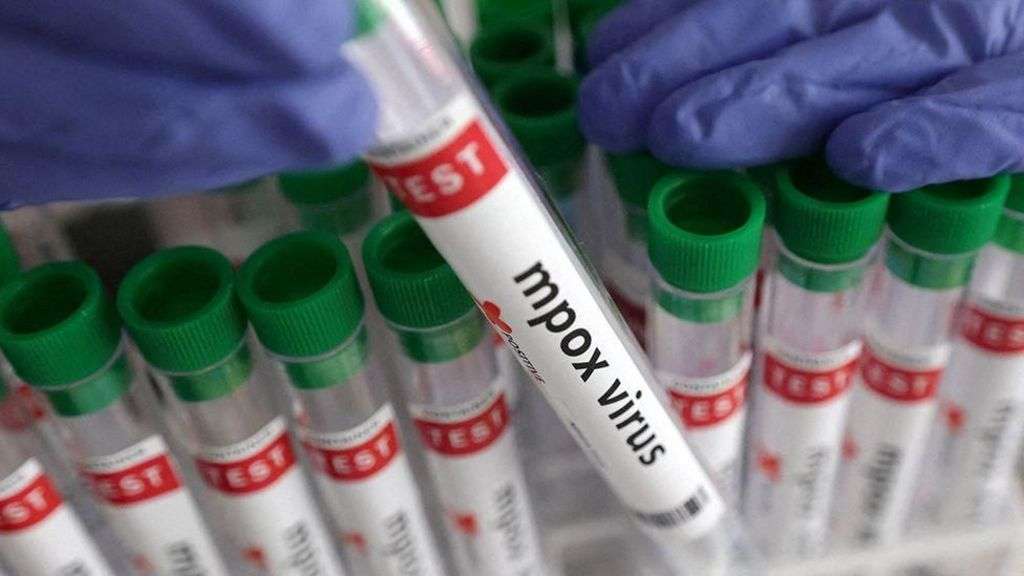 First case of newer mpox variant detected in Ireland