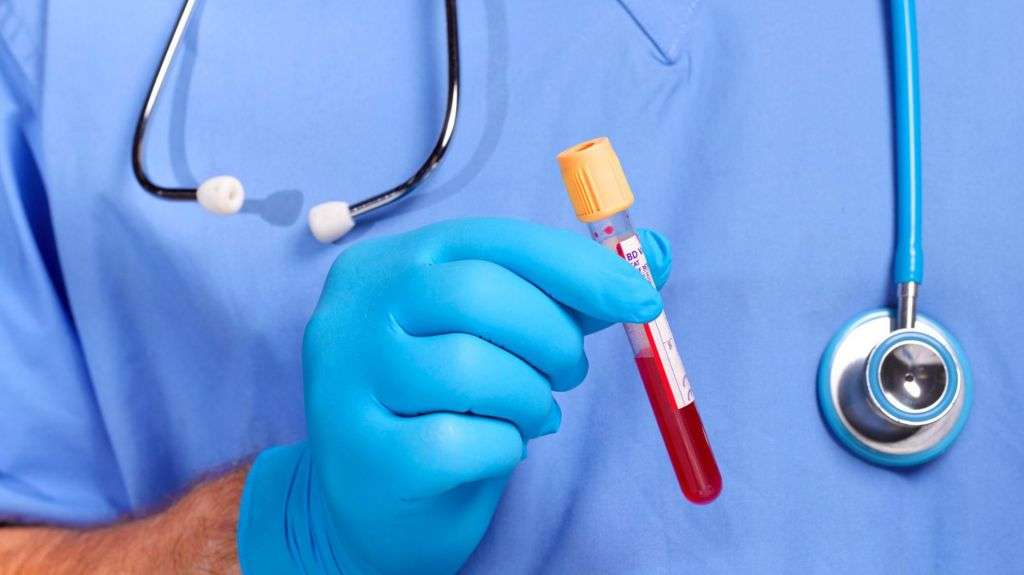 UK authorities on lookout for Lassa fever cases