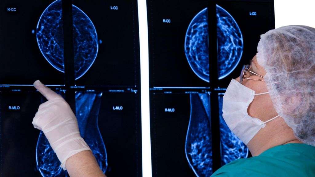 New pill can slow progression of incurable breast cancer