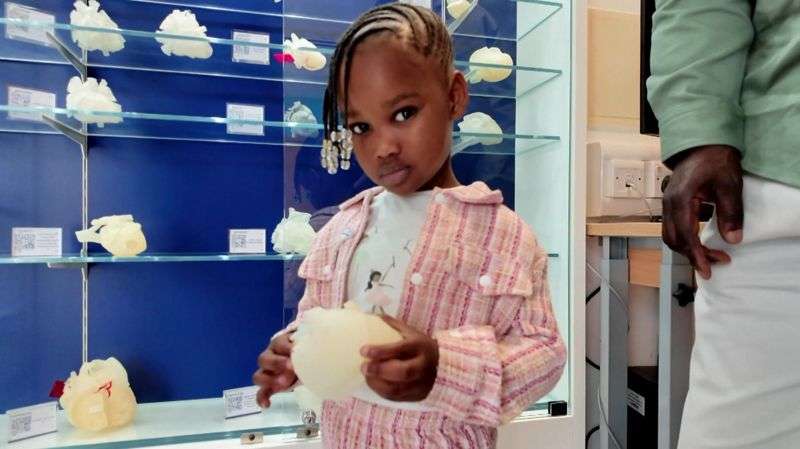 Ops revolutionised by 3D heart models, surgeon says