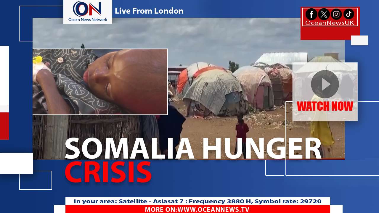 Somalia’s Child Malnutrition Crisis Deepens
